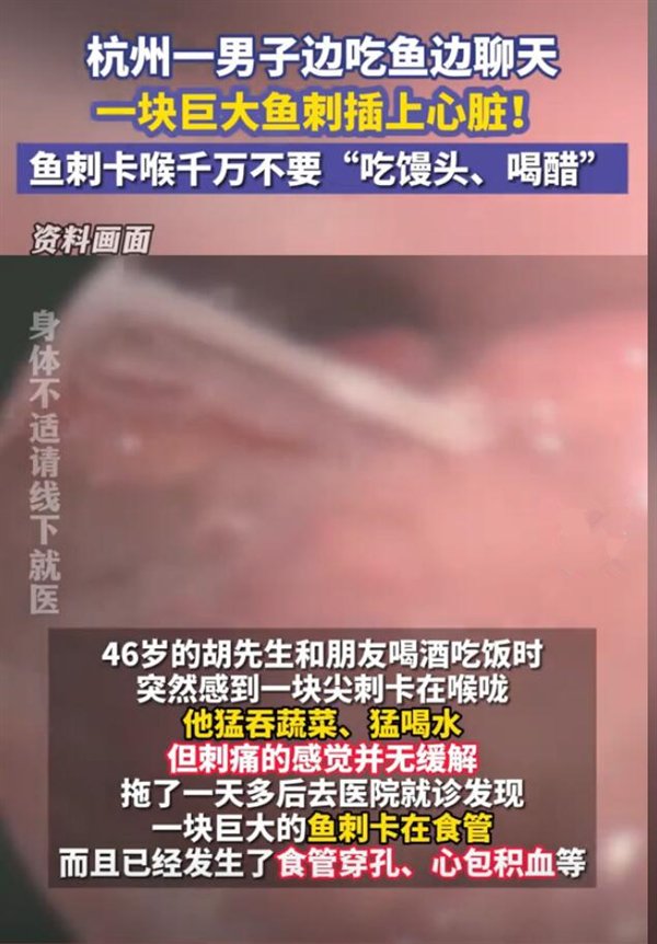 男子被巨大鱼刺扎入心脏，幸运获救